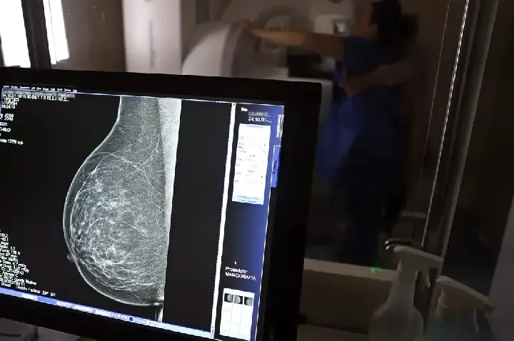 Médicos lançam guia para evitar recusa de mamografia digital
